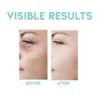 OOTD Wrinkle Lift Retinol Serum 50ml - DODOSKIN