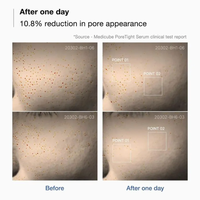 MEDICUBE Zero Pore One Day Serum 30ml