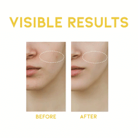 OOTD Dark Spot Vitamin C Serum 50ml - DODOSKIN