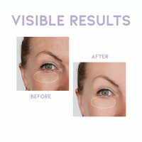 OOTD Overnight Eye Cream P.M 25g - DODOSKIN