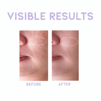 OOTD Glycolic Exfoliating Toner P.M 250ml - DODOSKIN
