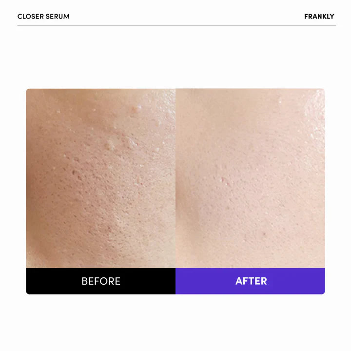 FRANKLY Closer Serum 100ml