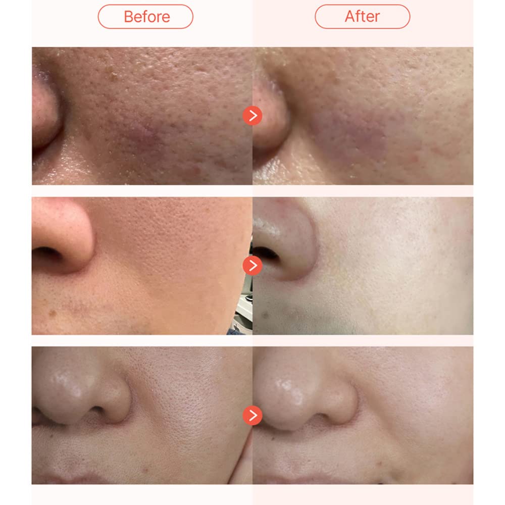 Parnell Apple Vinegar Pore Pad 60 pads