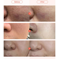 Parnell Apple Vinegar Pore Pad 60 pads