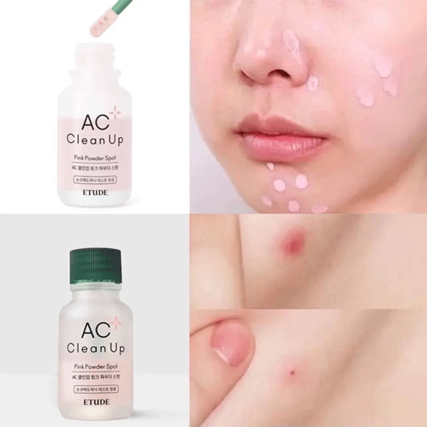 Helps to dry out pimples and reduce the appearance of acne.