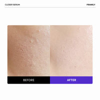 FRANKLY Closer Serum 100ml
