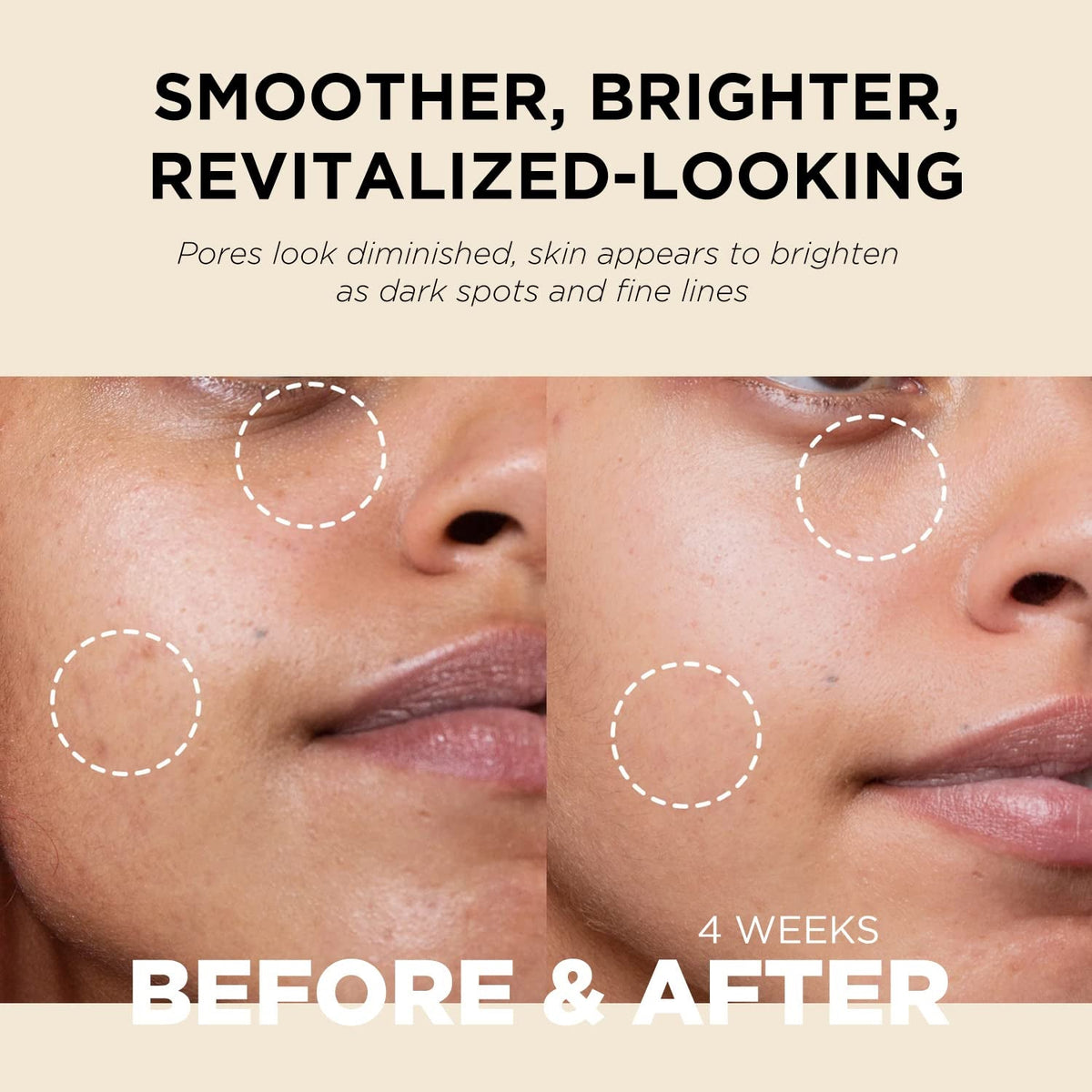 It's SKIN Retinoidin Cream 100ml