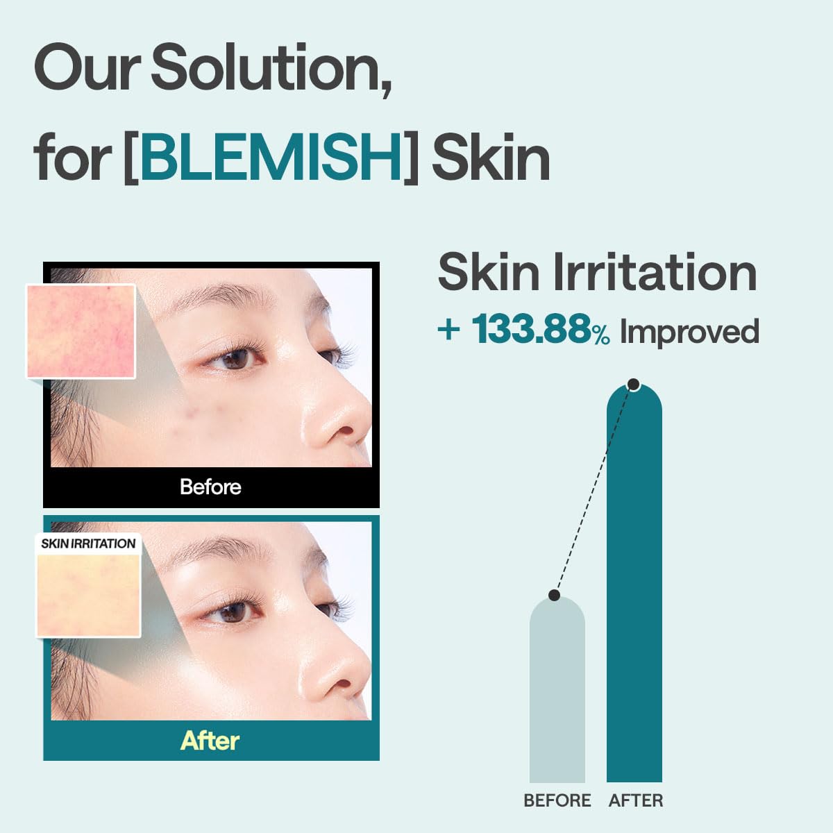 MEDIHEAL Madecassoside Essential Mask Blemish Repair 10ea