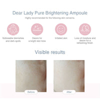 Dermamular Dear Lady Pure Brightening Ampoule 30ml - Dodoskin
